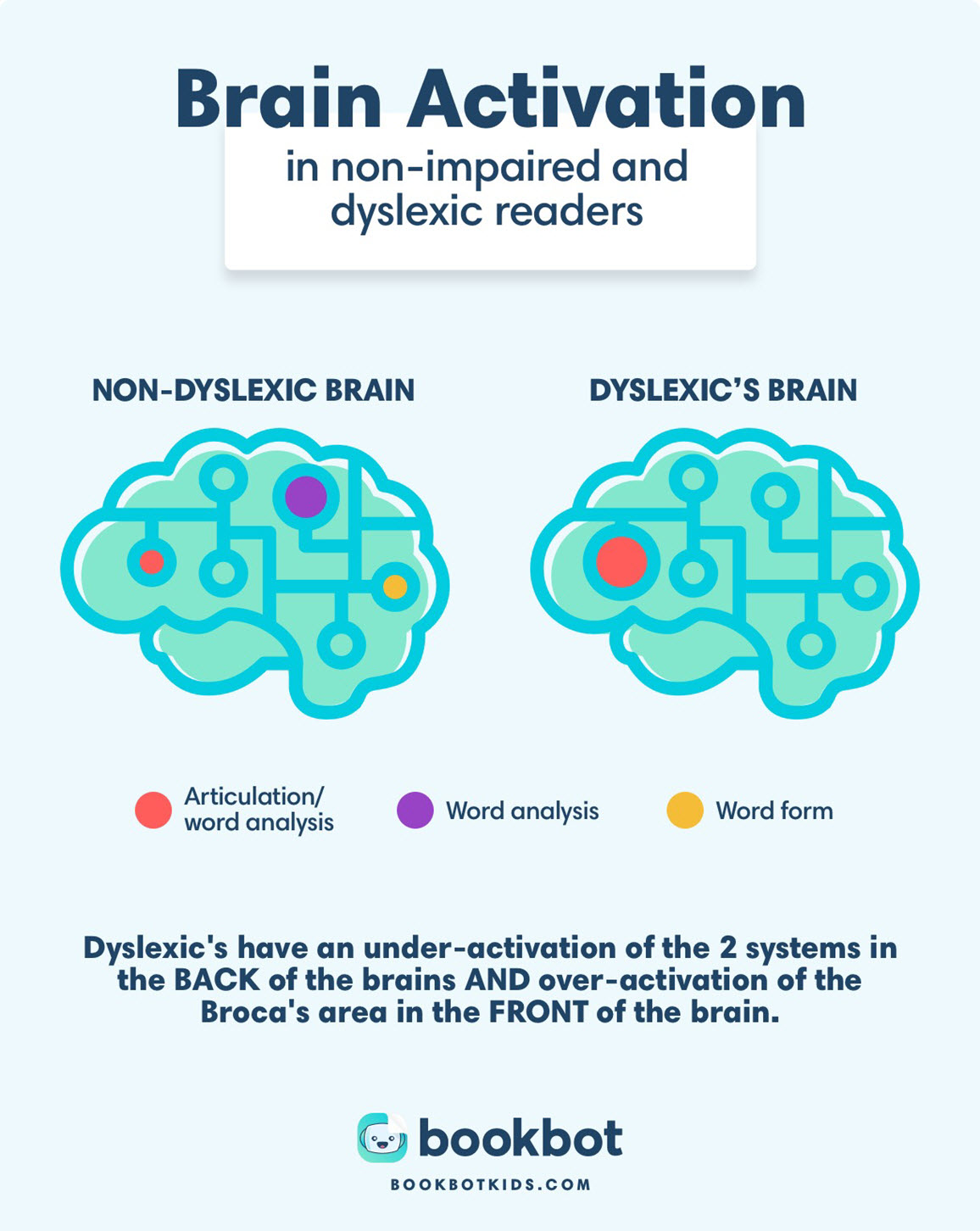 dyslexia brain